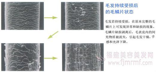 毛发持续(xù)受损(sǔn)后的毛鳞片状态-发质与毛发受损之关系 毛(máo)发持续受损(sǔn)后(hòu)的毛鳞片状态(tài)-发(fā)质与毛发受损(sǔn)之关系